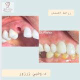وهبي زرزور