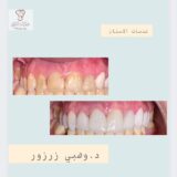 وهبي زرزور