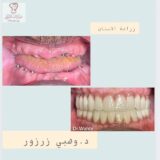 وهبي زرزور