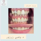 وهبي زرزور